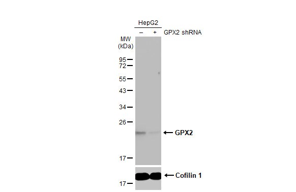 Glutathione Peroxidase 2/GPX2 Antibody (HL125)