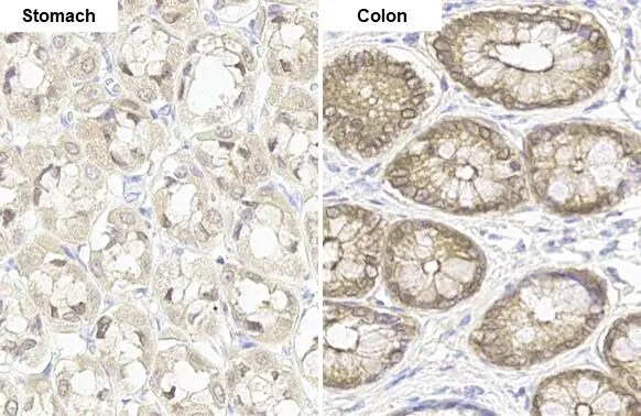 Glutathione Peroxidase 2/GPX2 Antibody (HL125)