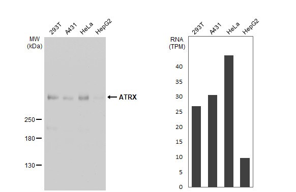 ATRX Antibody (HL1210)