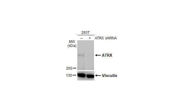 ATRX Antibody (HL1210)