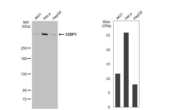 53BP1 Antibody (HL275)