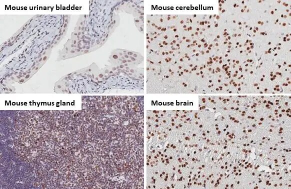 53BP1 Antibody (HL275)