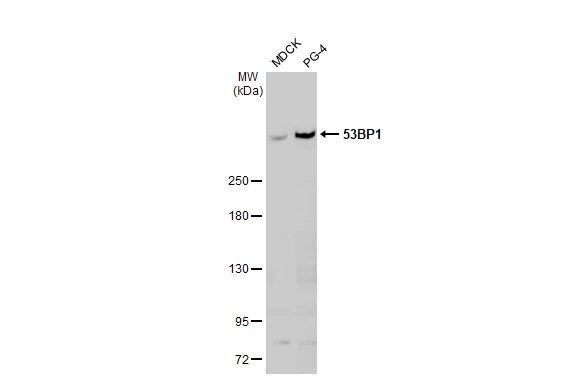 53BP1 Antibody (HL275)