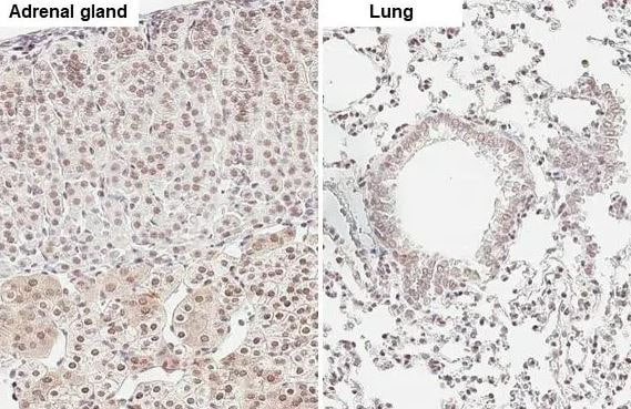 ATR [p Thr1989] Antibody (HL132)