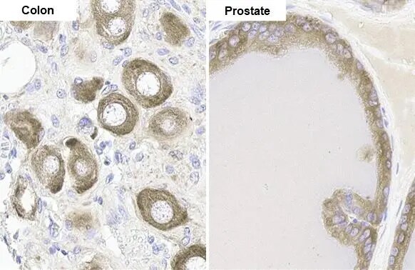 FACL4 Antibody (HL229)