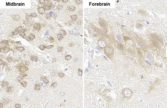GLI-1 Antibody (HL247)