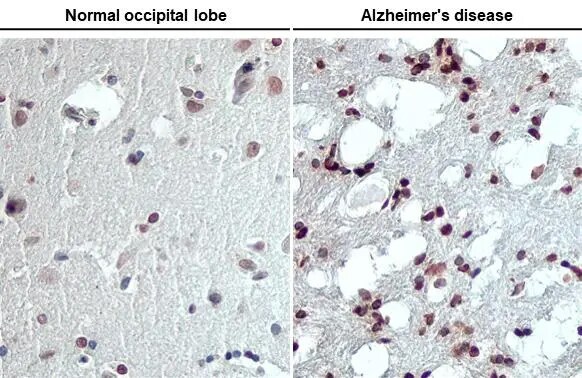 Lyn [p Tyr397] Antibody (HL122)