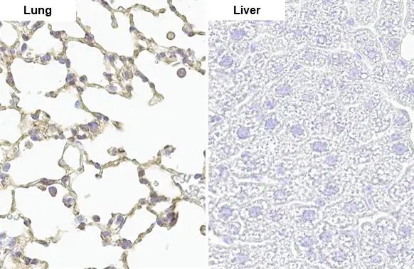 Lyn [p Tyr397] Antibody (HL122)
