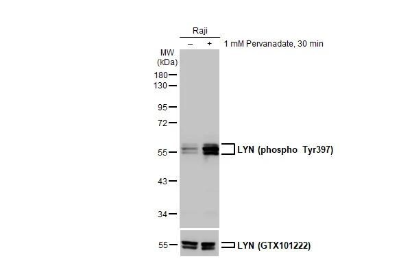 Lyn [p Tyr397] Antibody (HL122) - Azide and BSA Free