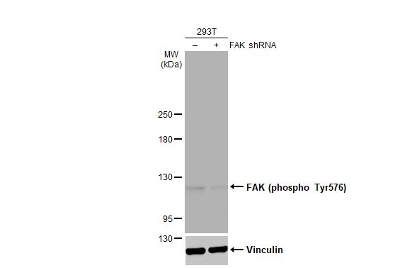 FAK [p Tyr576] Antibody (HL127)