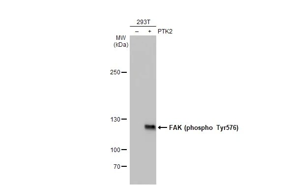 FAK [p Tyr576] Antibody (HL127)