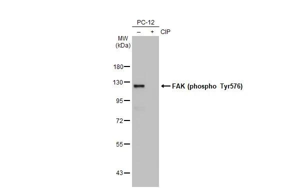 FAK [p Tyr576] Antibody (HL127) - Azide and BSA Free