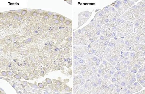 VPS35 Antibody (HL1017)