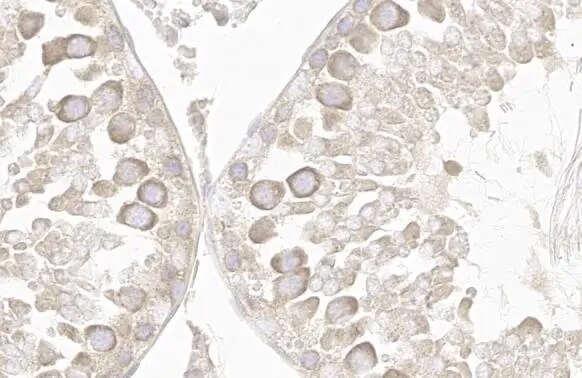 VPS35 Antibody (HL1017)
