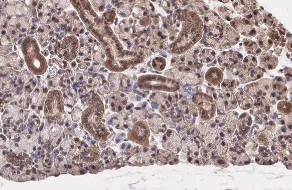 Nrf2 Antibody (HL1021) - Azide and BSA Free