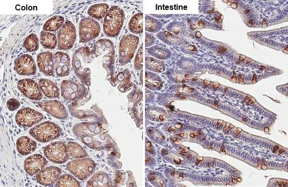 AG-2/AGR2 Antibody (HL1024)