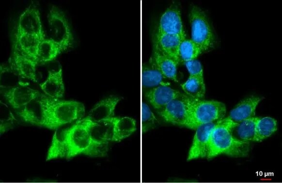 AG-2/AGR2 Antibody (HL1024)
