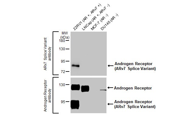 Androgen R/NR3C4 Antibody (HL1028) - ARv7 Variant