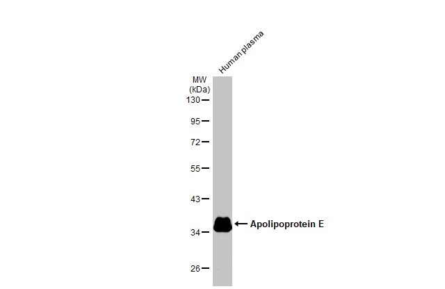 Apolipoprotein E/ApoE Antibody (GT27711)