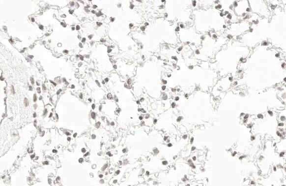 RPB2 Antibody (HL1042)