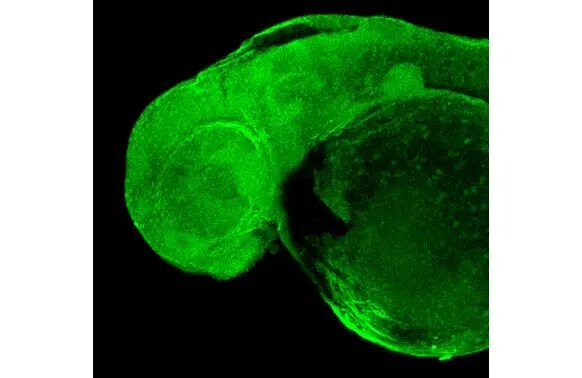 RPB2 Antibody (HL1042)
