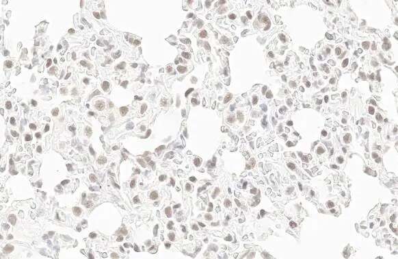 RPB2 Antibody (HL1042)
