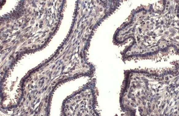 RPB2 Antibody (HL1042)
