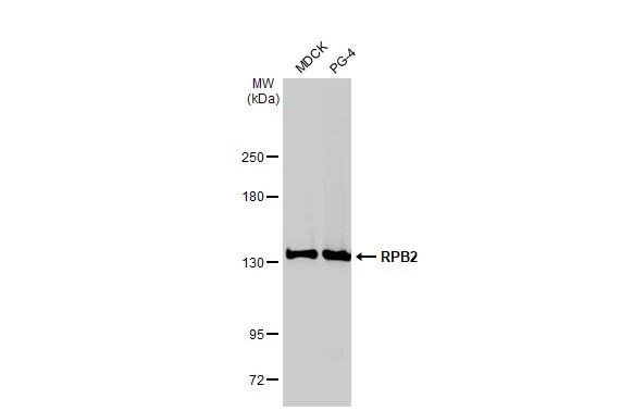 RPB2 Antibody (HL1042)