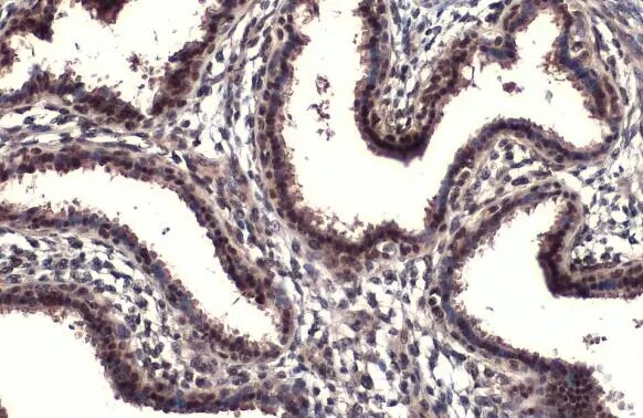RPB2 Antibody (HL1043)
