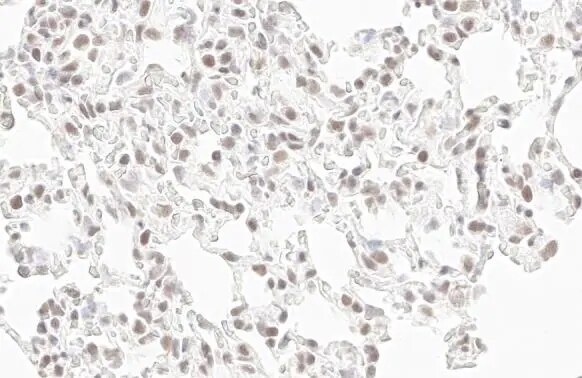 RPB2 Antibody (HL1043)