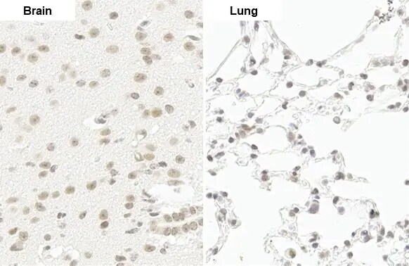 RPB2 Antibody (HL1043)