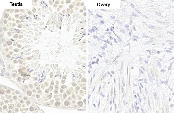 cIAP-1/HIAP-2 Antibody (HL1045)