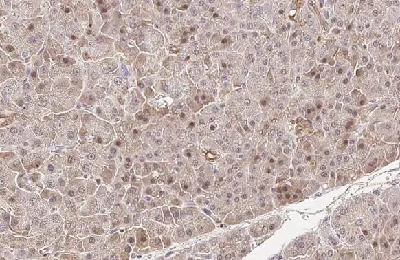 cIAP-1/HIAP-2 Antibody (HL1045)