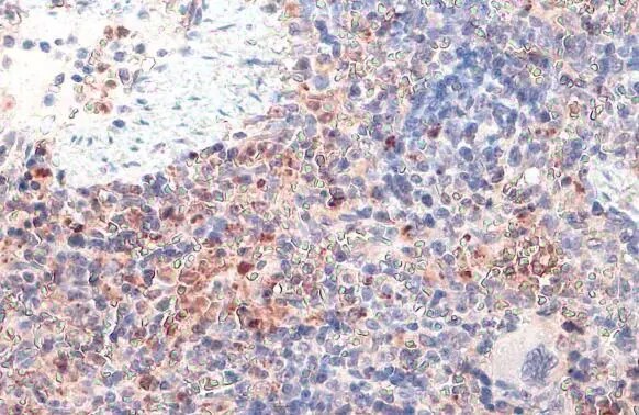 cIAP-1/HIAP-2 Antibody (HL1045)