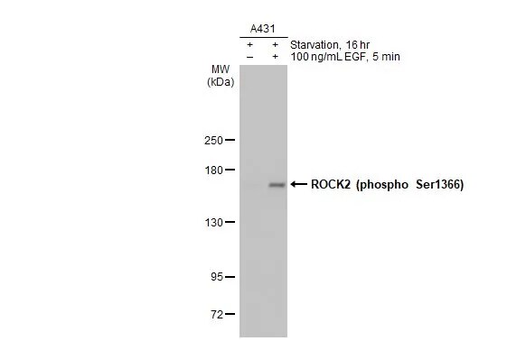 ROCK2 [p Ser1366] Antibody (HL1071)