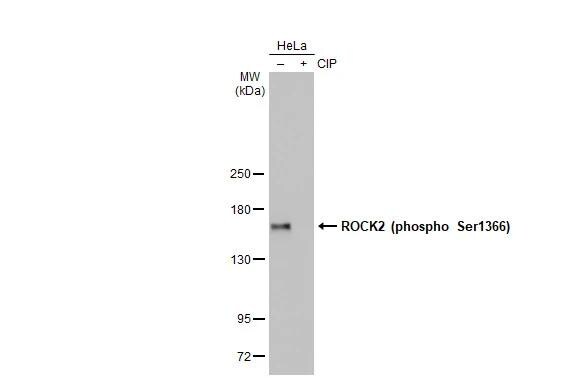 ROCK2 [p Ser1366] Antibody (HL1071) - Azide and BSA Free