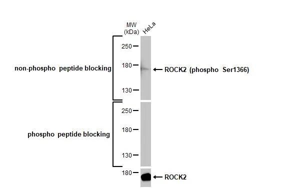 ROCK2 [p Ser1366] Antibody (HL1071) - Azide and BSA Free