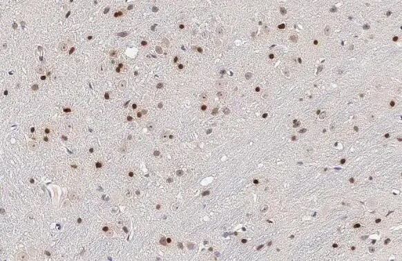 Olig2 Antibody (HL1072)