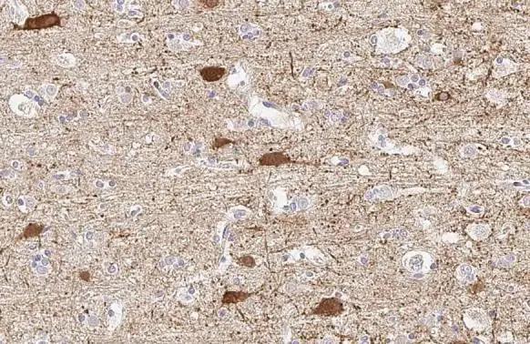GAD1/GAD67 Antibody (HL1096) - Azide and BSA Free