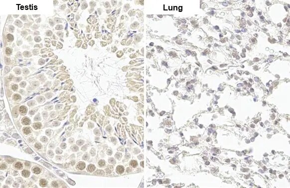 CLOCK Antibody (HL1099)
