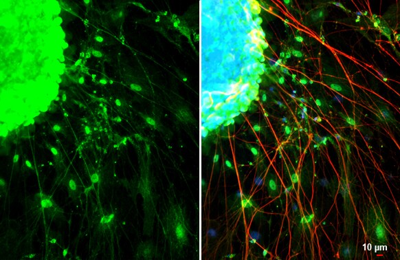 Somatostatin Antibody (HL1101)