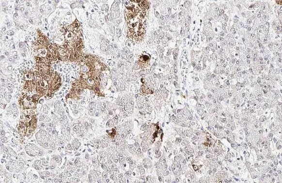 Somatostatin Antibody (HL1101)