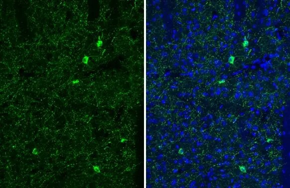 Somatostatin Antibody (HL1101)
