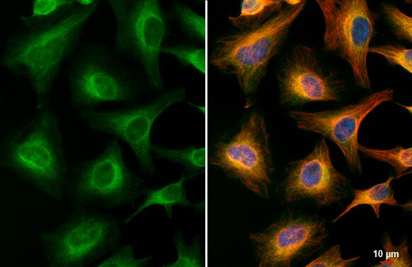 Acetylcholinesterase/ACHE Antibody (HL1102)