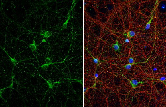 Acetylcholinesterase/ACHE Antibody (HL1102)