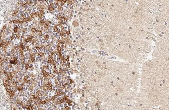 Acetylcholinesterase/ACHE Antibody (HL1102)