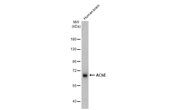 Acetylcholinesterase/ACHE Antibody (HL1102)