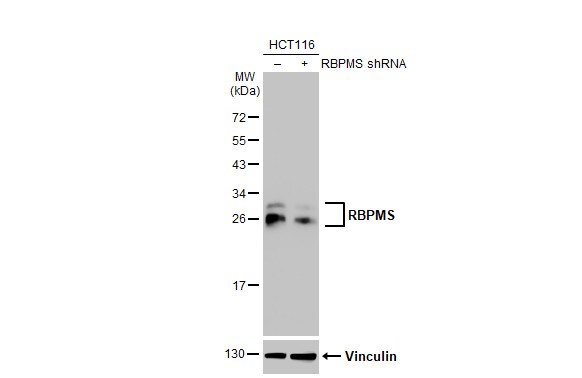 RBPMS Antibody (HL1105) - Azide and BSA Free