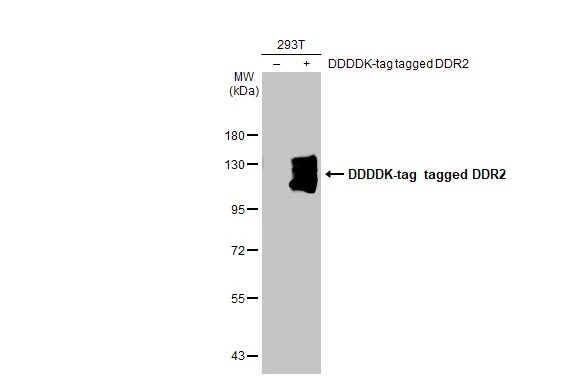 DDR2 Antibody (HL1107)