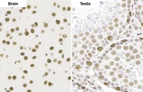 BRM Antibody (HL1115)